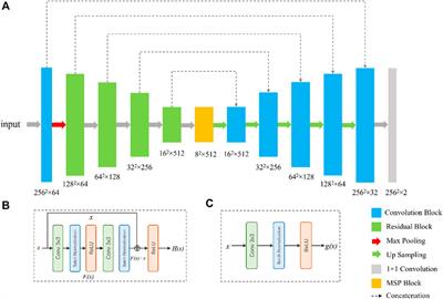 Is histogram manipulation always beneficial when trying to improve model performance across devices? Experiments using a Meibomian gland segmentation model